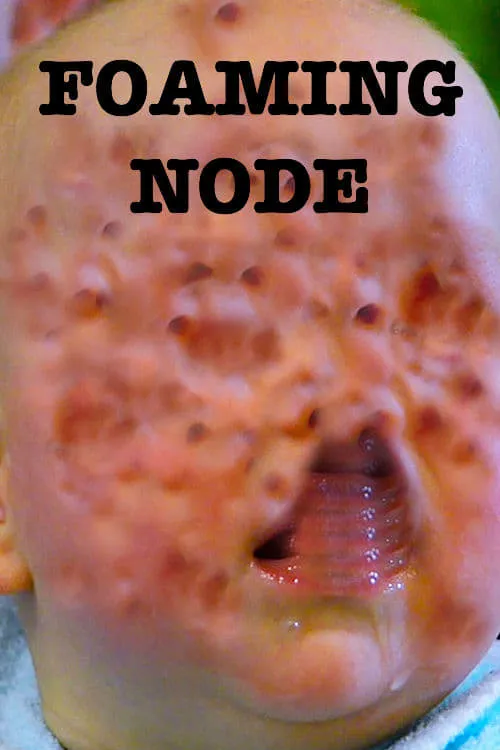 The Foaming Node (фильм)