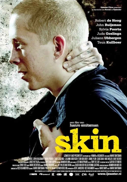 Skin (movie)