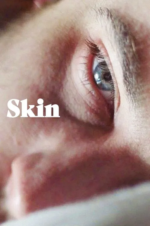 Skin (movie)