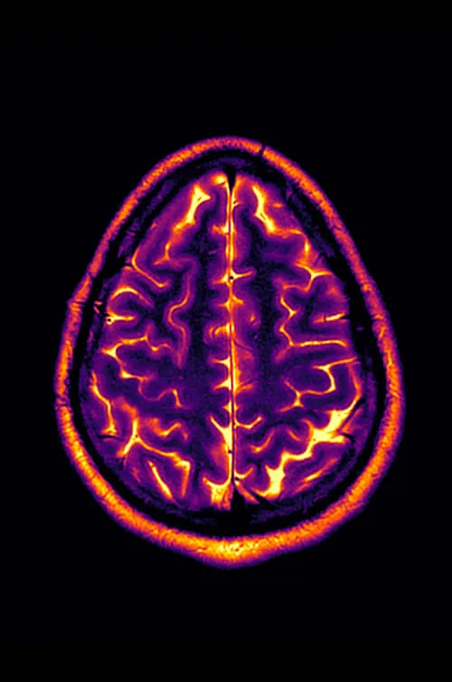 Conclusion: Stable Disease (фильм)