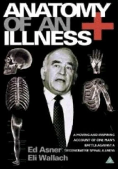 Anatomy of an Illness (фильм)